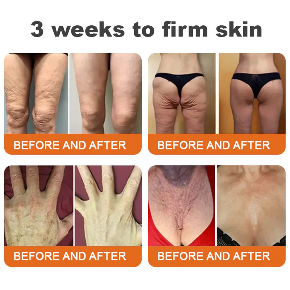 🌿Rolimey® Bee venom Pro Comprehensive Cream —Tightening for Skin Types 🔥