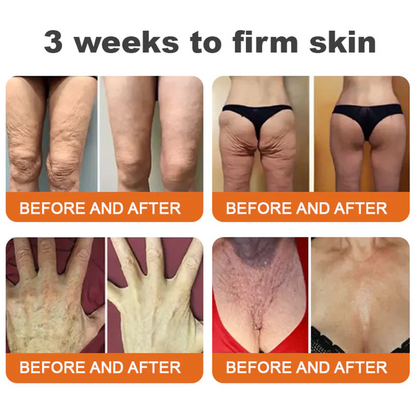 🌿Rolimey® Bee venom Pro Comprehensive Cream —Tightening for Skin Types 🔥