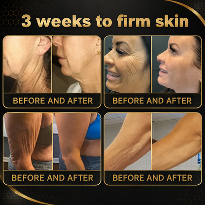 🌿Rolimey® Bee venom Pro Comprehensive Cream —Tightening for Skin Types 🔥